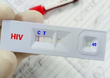 کاهش سهم «اعتیاد» در انتقال HIV؛ توضیح وزارت بهداشت درباره تغییر الگوی انتقال بیماری