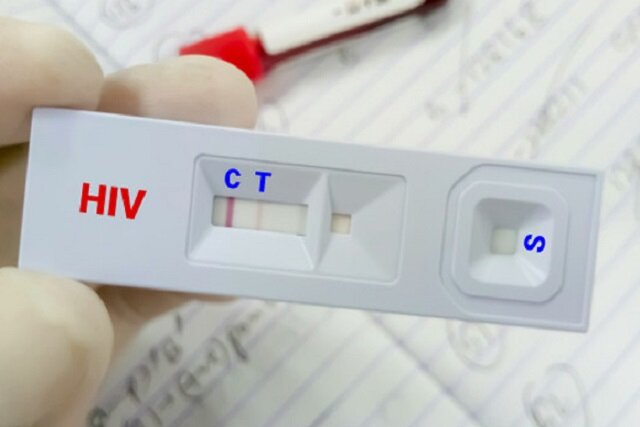 کاهش سهم «اعتیاد» در انتقال HIV؛ توضیح وزارت بهداشت درباره تغییر الگوی انتقال بیماری